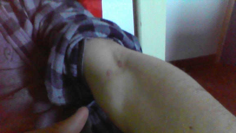 help infection ?