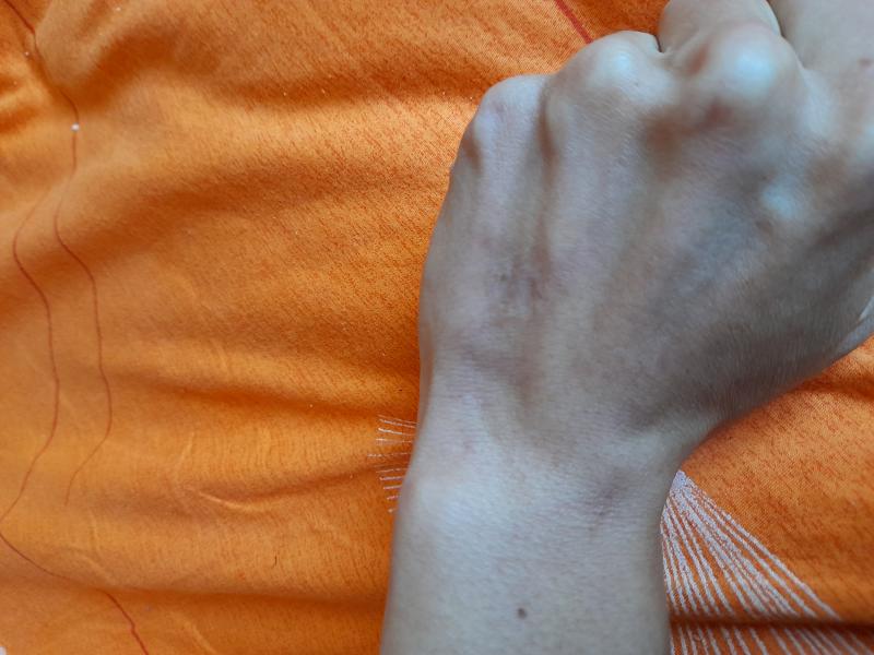 Brûlures de Baslow Brûlures de Baslow