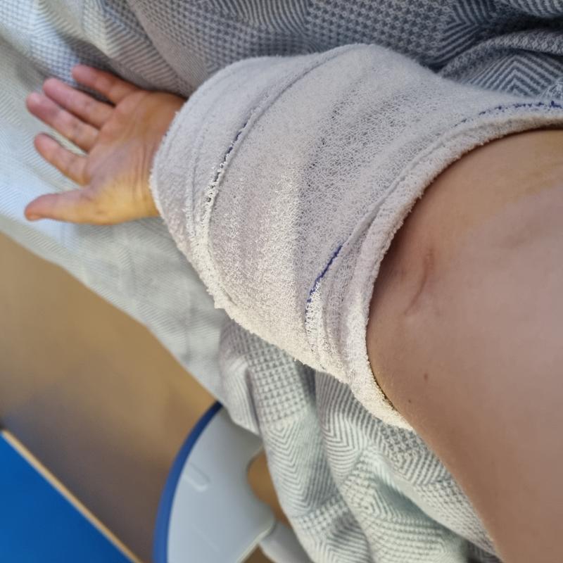 bras gauche 2 abcès