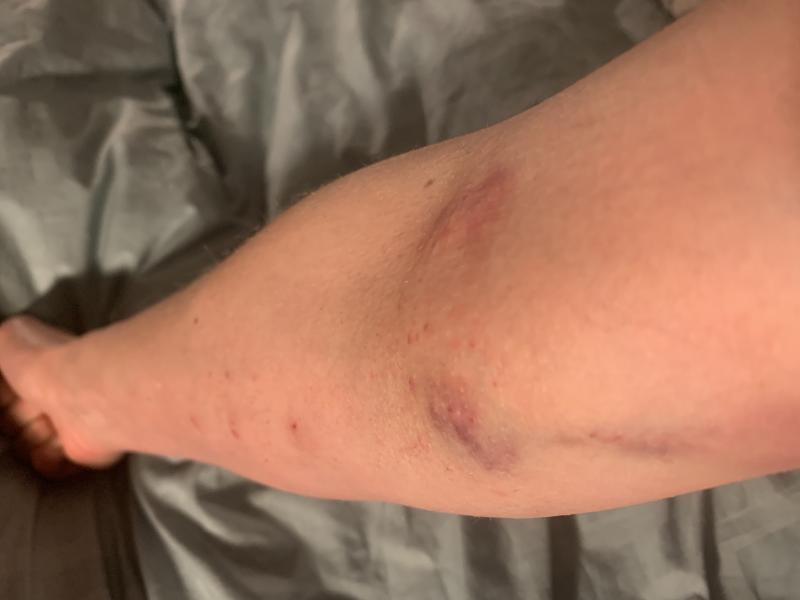 Âme sœur de bras massacré Âme sœur de bras massacré