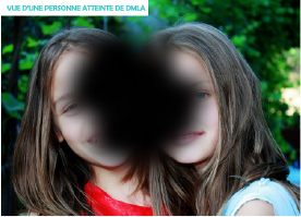 /forum/uploads/images/1680/enfantdmla.png